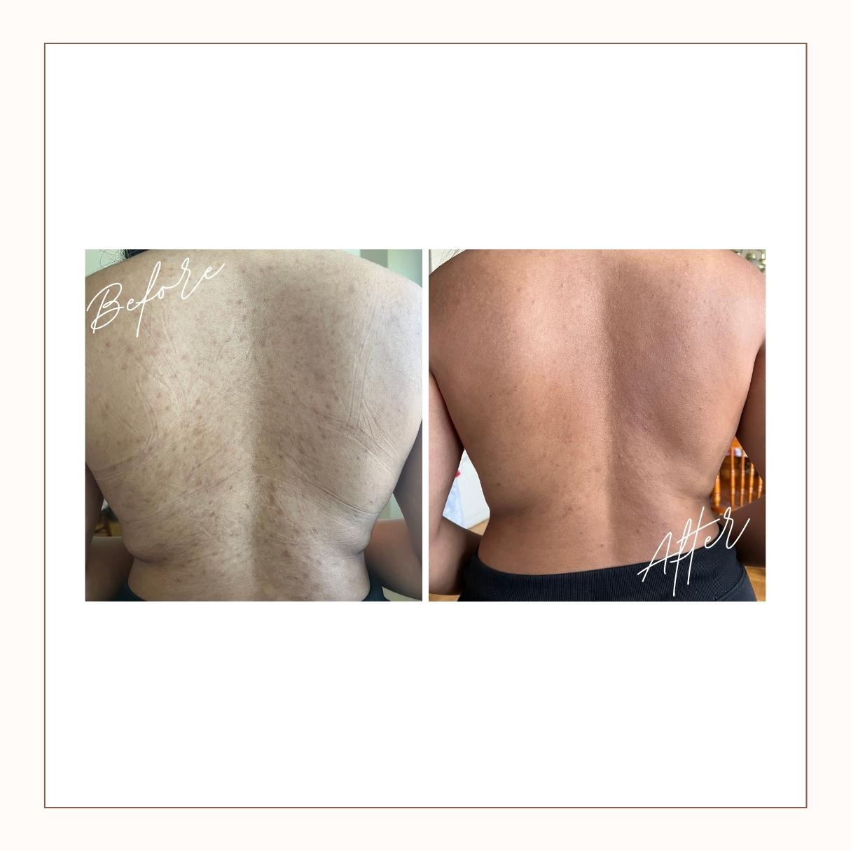 Breathtaking Back